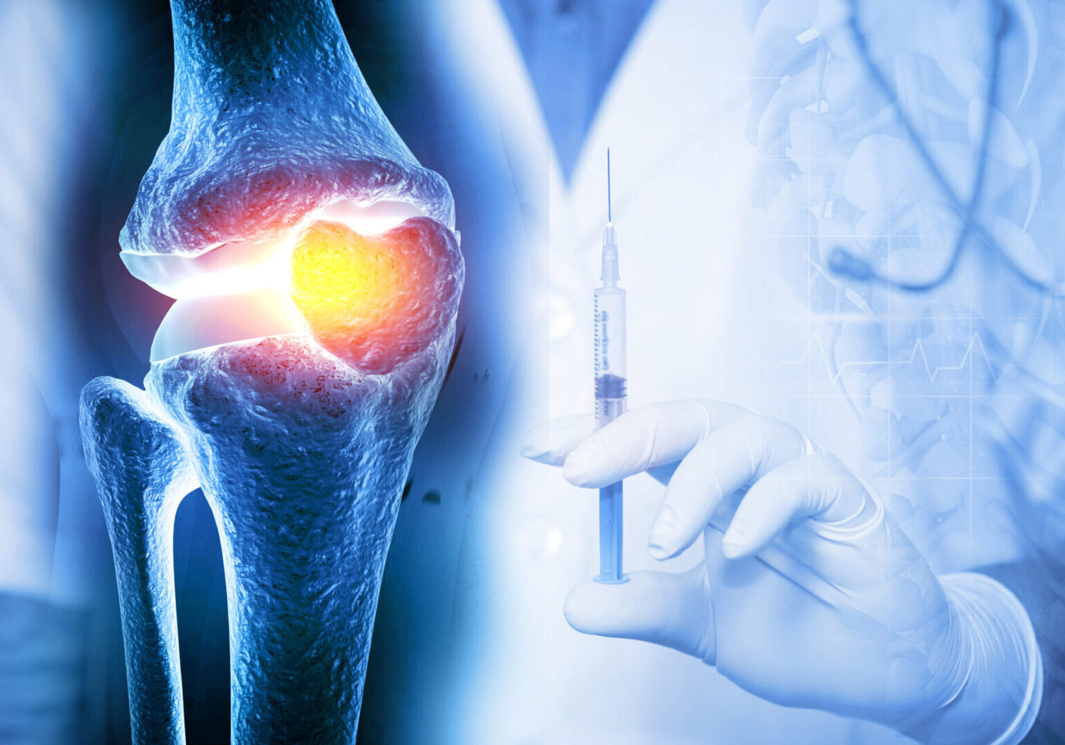 A person holding a needle in their hand and an image of a knee.